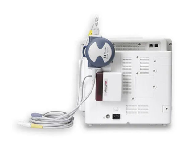 Modular Patient Monitor - Image 4