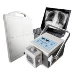 Medical Mobile Portable Digital  X Ray Machine